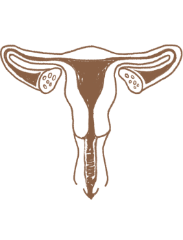 dessin d'un uterus avec fluide